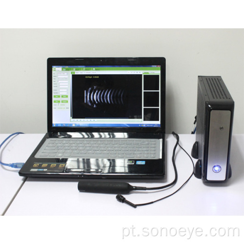 Labtop e PC ophthalmic scanner box